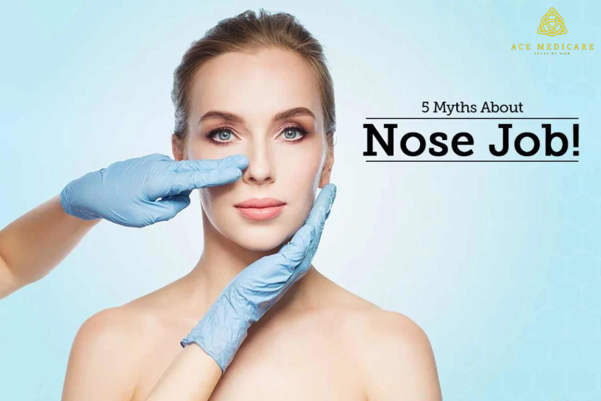 5 Common Misconceptions About Rhinoplasty Debunked